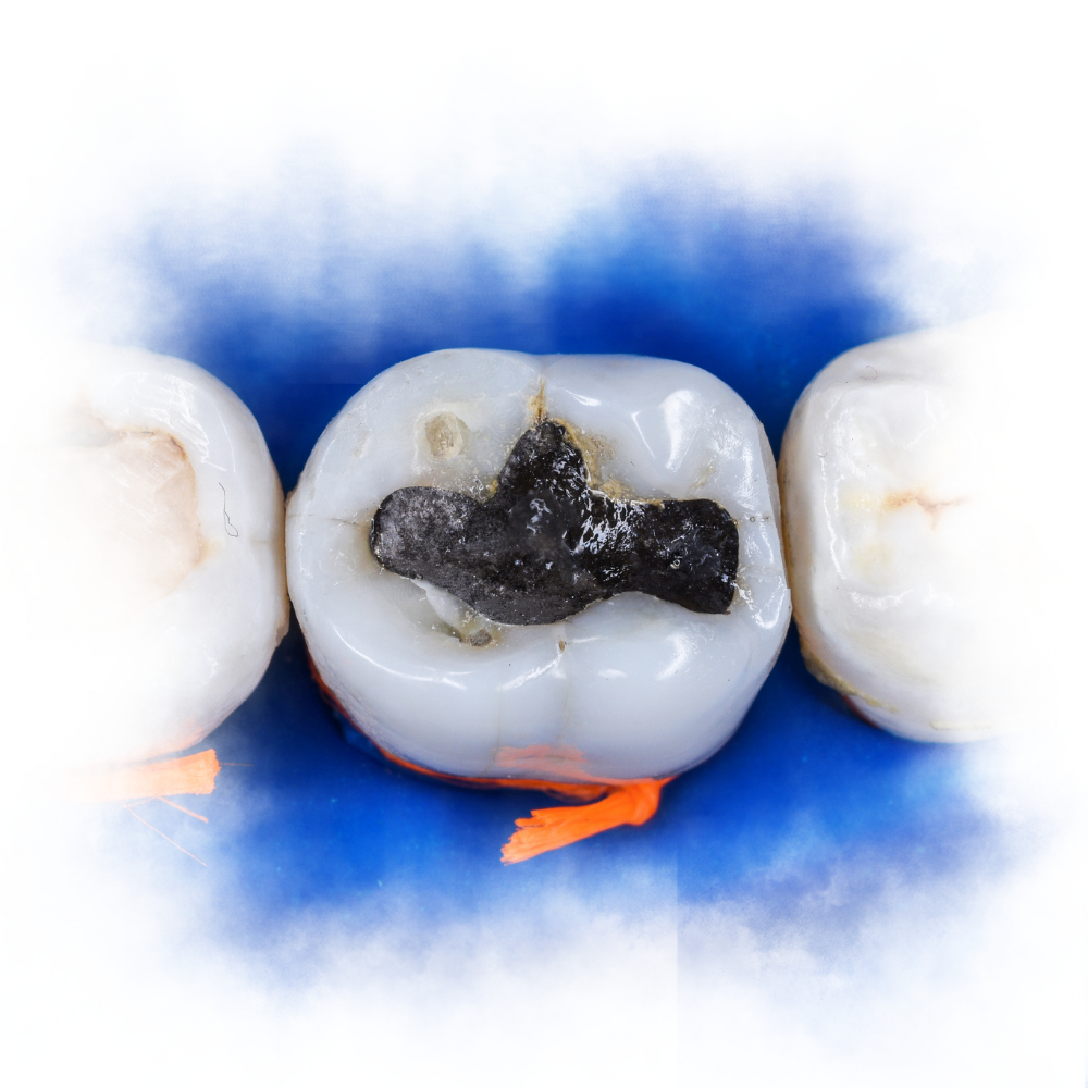fit and fissure