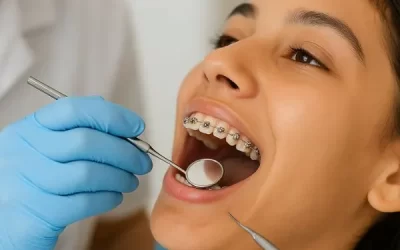 Cara Merawat Behel Gigi Biar Tetap Nyaman & Bersih